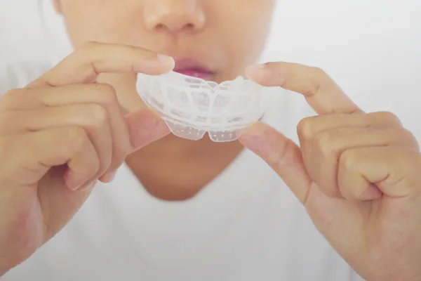 スポーツマウスガード